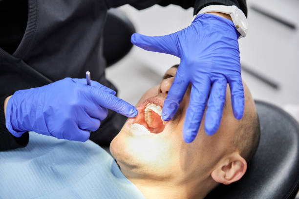 Best Knocked-Out Tooth Emergency  in Hornell, NY